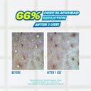 Jumiso Blackhead Melting Softener & Cotton Pad Set