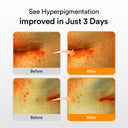 Abib Glutathiosome Dark Spot Serum Vita Drop 50ml