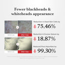 Medicube Hypochlorous Acid Rice Peel Shot 80ml