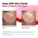 ANUA Niacinamide 10% + TXA 4% Dark Spot Correcting Serum 30ml