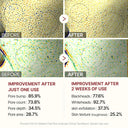 Dr.Melaxin Peel Shot Exfoliating Black Rice Ampoule 80ml