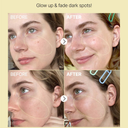 COSRX The Vitamin C 23 Serum before and afrer