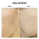 NUMBUZIN No.5 Vitamin-Niacinamide Concentrated Pad (70Pads) Reviews
